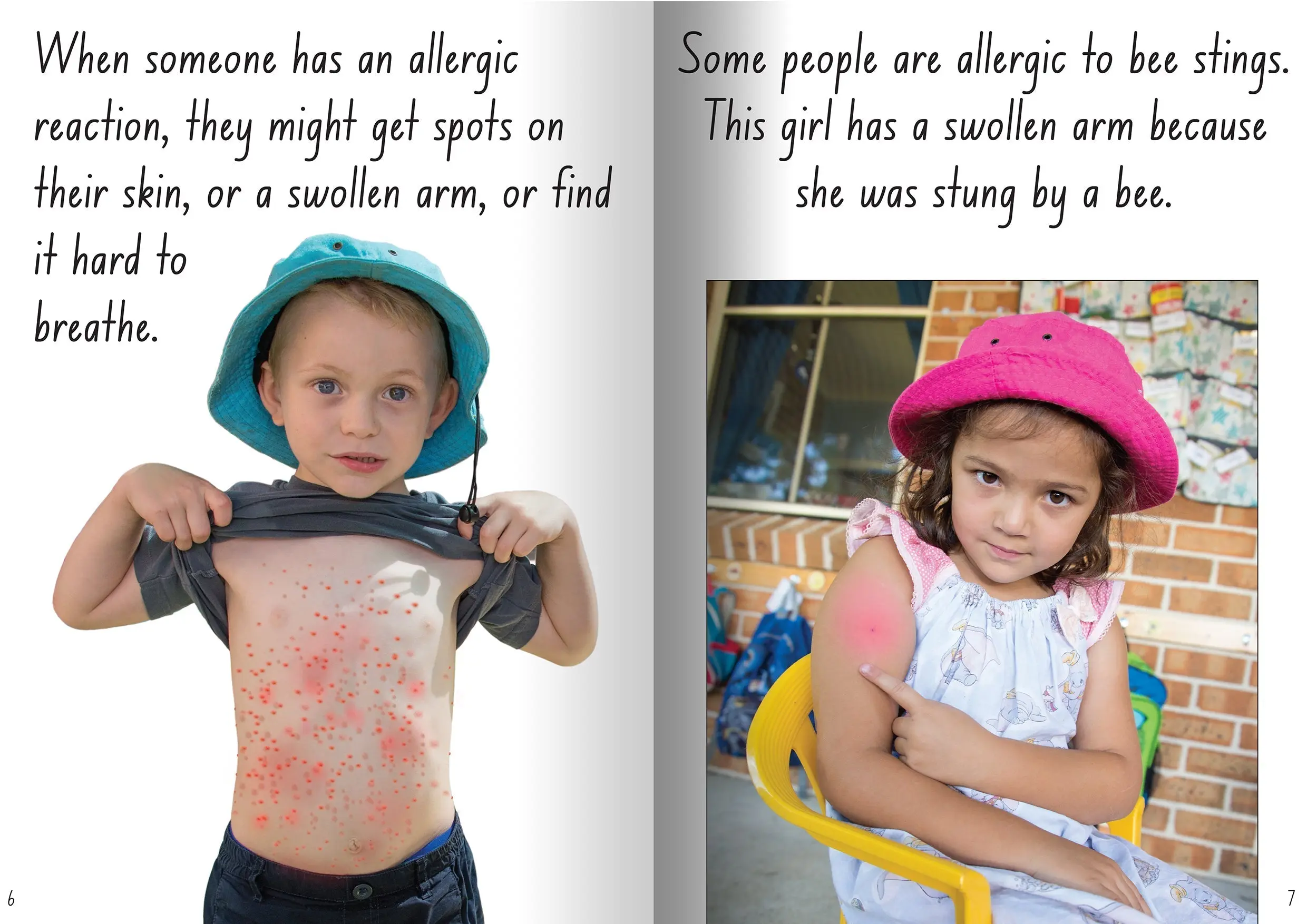 Let's Learn about Allergies Big Book - Image 3
