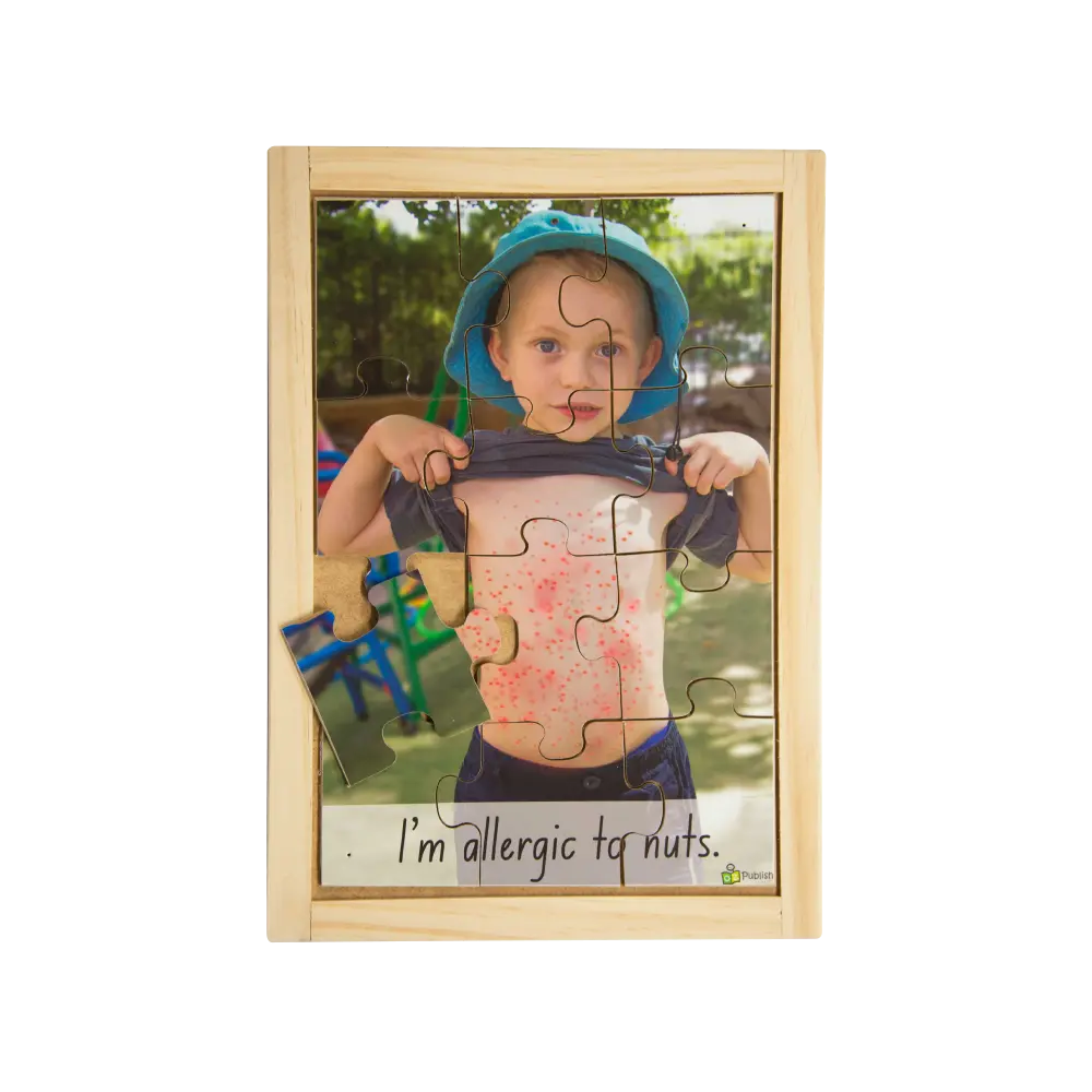 Nut Allergy Puzzle